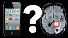 Do-Cell-Phones-Cause-Brain-Tumors-attachment