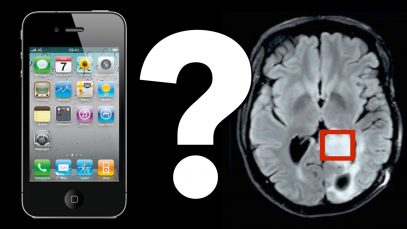Do-Cell-Phones-Cause-Brain-Tumors-attachment
